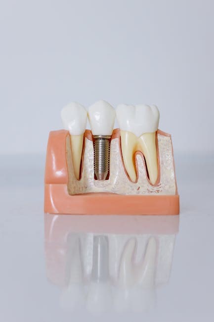 implant