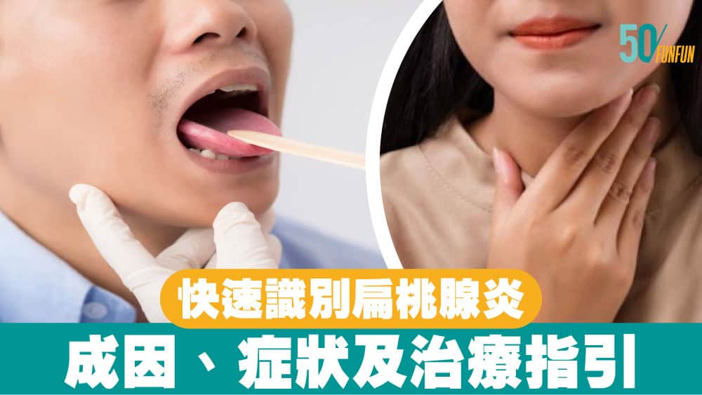 快速識別扁桃腺炎：成因、症狀及治療指引