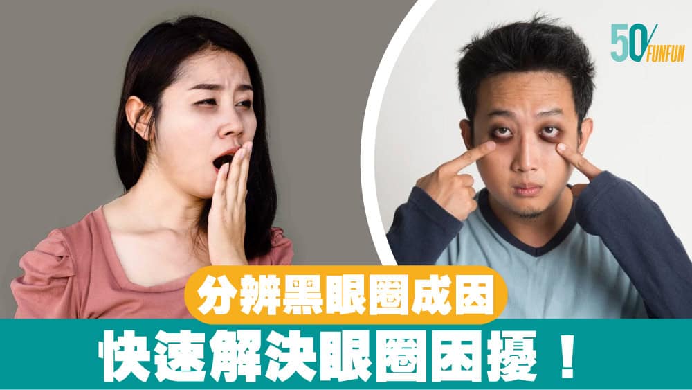 3步驟分辨黑眼圈成因：快速解決眼圈困擾！